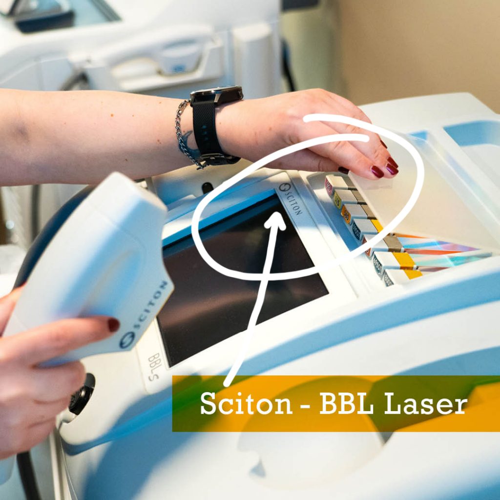 Advanced Skin Specialist Christina Makrodimitras working with Sciton BBL Laser machine