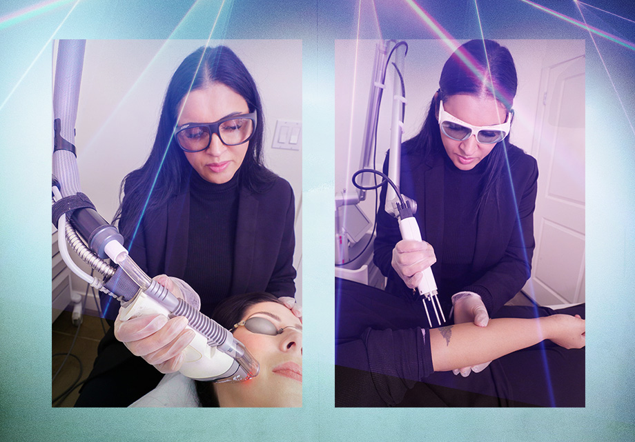 laser treatments by Blanche grad Jas Sahota